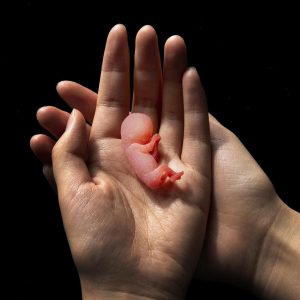 Clinical model 11 weeks gestation