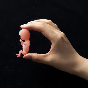 Clinical model 12 weeks gestation