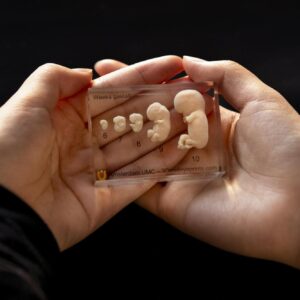 Clinical model 6-10 weeks -  Transparent