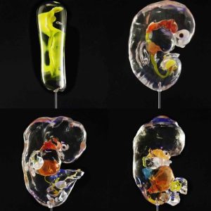 Complete set Gastrointestinal